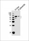 SCP2 Antibody (C-term)